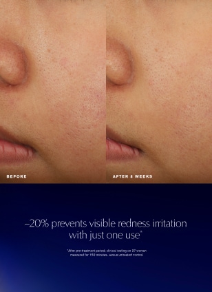 Advanced Night Repair Recovery Treatment Essence/Treatment Lotion