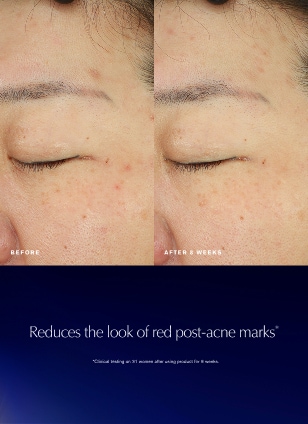 Advanced Night Repair Recovery Treatment Essence/Treatment Lotion
